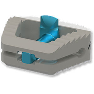 Caja intersomática cervical - ARION - Osimplant - vía anterior / de PEEK / extensible