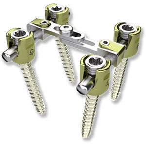Sistema de osteosíntesis toracolumbar - ON PLUS - Osimplant - vía posterior / para adulto