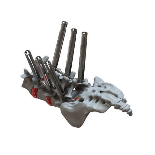 Sistema de posicionamiento de tornillos pediculares mínimamente invasivo - ATHENA - Osimplant