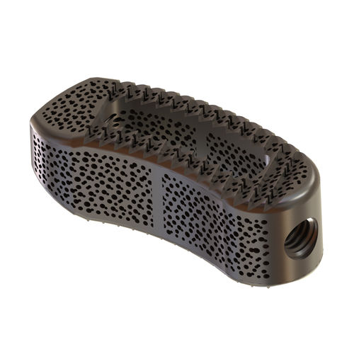 Caja intersomática lumbar - TERRACOTTA TLIF - Osimplant - vía transforaminal / de titanio