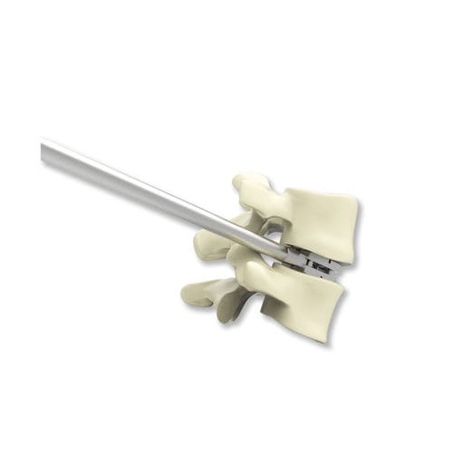 Caja intersomática lumbar - ELYON - Osimplant - vía anterior / de titanio / extensible