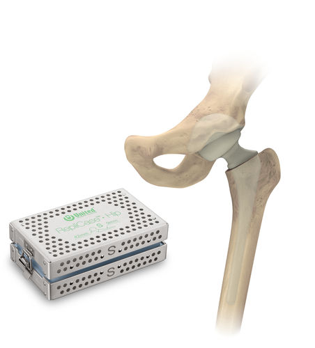 Espaciador temporal para cadera - RepliCase™ - US Orthopedics