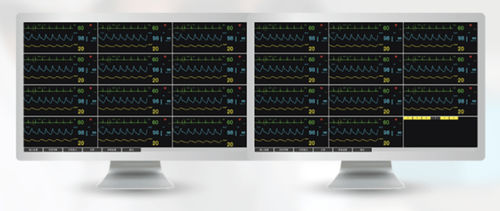 Central de monitorización del paciente - WCMS-88 - Wisonic - 64 camas
