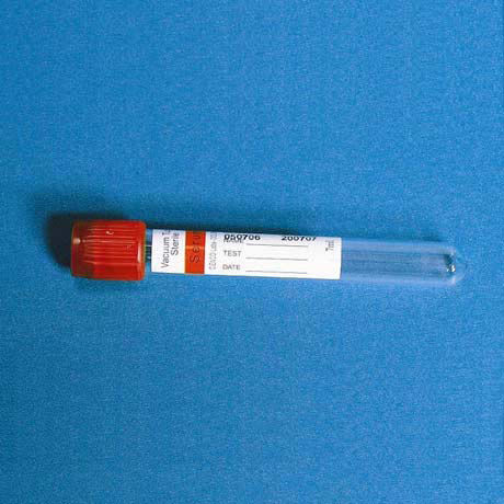 Tubo de extracción de ESR - TK-91xx series - TENKO MEDICAL SYSTEM CORP - cilíndrico / de sangre / para extracción de muestras
