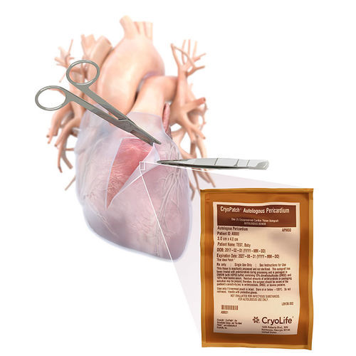 Matriz tisular cirugía cardíaca - CryoPatch - Cryolife - alotrasplante