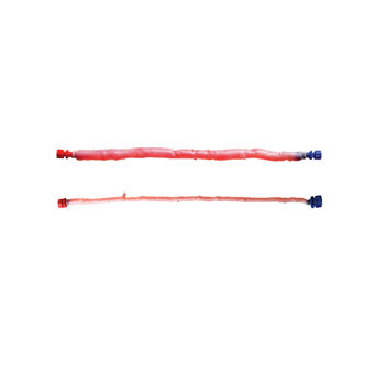 Bioprótesis vascular arteria pulmonar - CryoVein® PC - Cryolife - alotrasplante / pediátrica