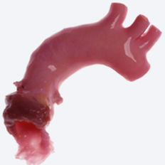 Bioprótesis vascular aorta - CryoValve® - Cryolife - alotrasplante / con válvula