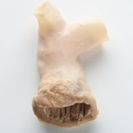 Bioprótesis vascular arteria pulmonar - CryoValve® SG - Cryolife - alotrasplante / con válvula
