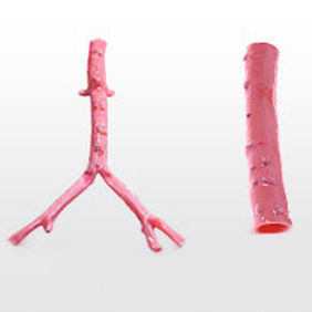 Bioprótesis vascular arteria ilíaca - CryoArtery® - Cryolife - alotrasplante / bifurcada
