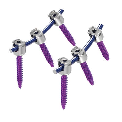 Sistema de osteosíntesis toracolumbar - MAS® - NuVasive - vía posterior / para adulto