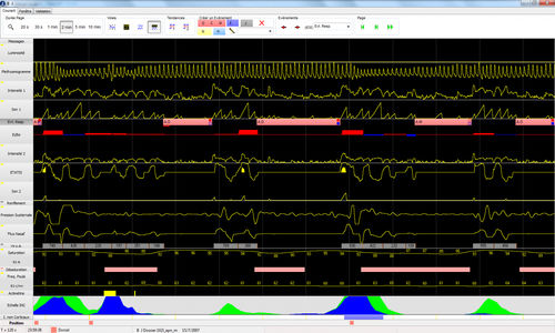 Software de análisis - CIDELEC - para informes / de visualización / de hospital