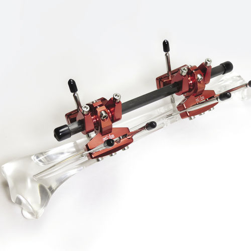 Fijador externo tubular - FIXUS66T - Fixus - para adulto / pediátrico