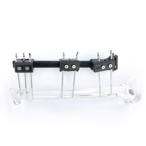 Fijador externo para tibia - FIXUS88 mini - Fixus - para fémur / para radio / para húmero