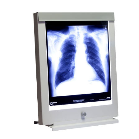Negatoscopio 1 pantalla - Rego X-ray - 2 pantallas / 3 pantallas / 4 pantallas