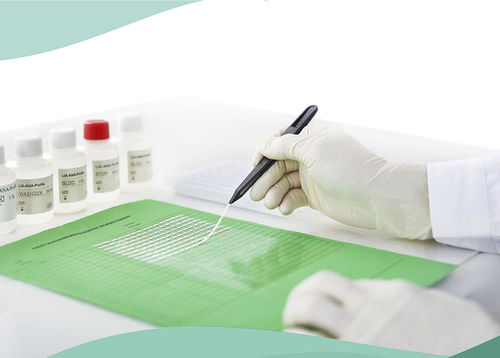 Tira de prueba de enfermedades autoinmunes - Shenzhen Yhlo Biotech Co., Ltd. - de enfermedades del hígado / de diabetes / de vasculitis