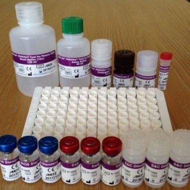 Kit de prueba de sepsis - PliNOSa® - TCS Biosciences Ltd - de plomo / por plasma / de inmunoanálisis