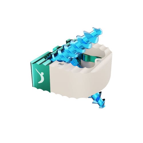 Caja intersomática cervical - PRORAY™  - Prodorth Spine - vía anterior / de PEEK