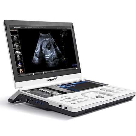 Ecógrafo portátil - VINNO8 - VINNO - para ecografía polivalente / 3D/4D / doppler-color