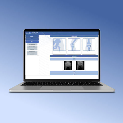 Software para ortopedia - medc-web-70 series - mediCAD Hectec GmbH - de gestión / de planificación / de planificación preoperatoria