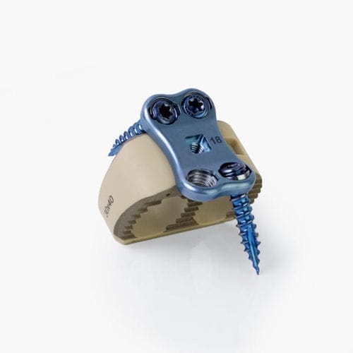 Caja intersomática lumbar - Idys®-ALIF - Clariance - vía anterior / de PEEK / con placa ósea lumbar