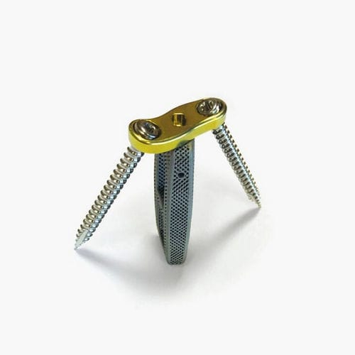 Caja intersomática lumbar - Idys®-LLIF 3DTi - Clariance - vía lateral / de titanio / con placa ósea lumbar