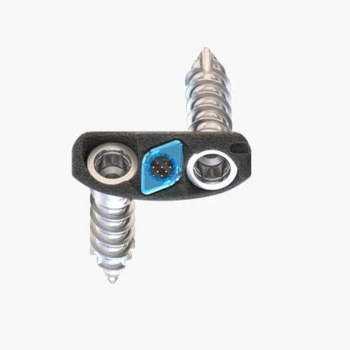 Caja intersomática cervical - Idys®-C ZP 3DTi - Clariance - vía anterior / de titanio