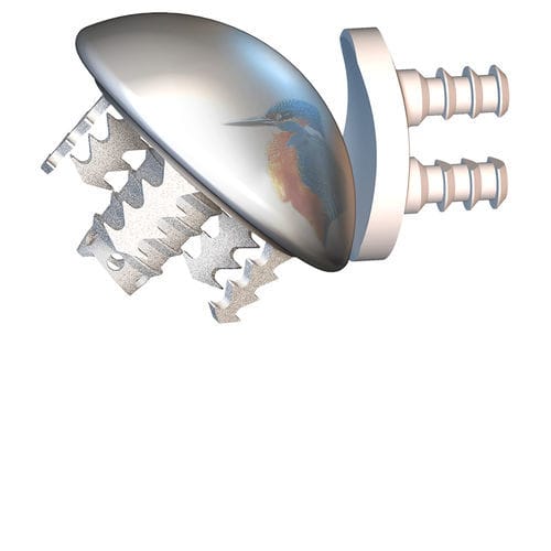 Prótesis de cabeza humeral no cementada - EASYTECH® - FX Solutions
