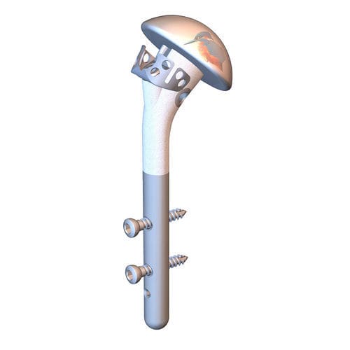 Tallo humeral de revisión - HUMELOCK II ® HEMI - FX Solutions - cementado o no cementado