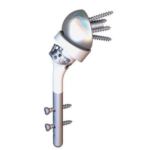 Tallo humeral inverso - HUMELOCK II® - FX Solutions - no cementado