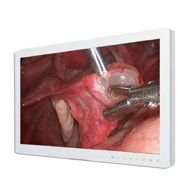 Monitor médico - FS-P2607D - 3D Medi Vision - 1920 x 1080 / VGA / 26"