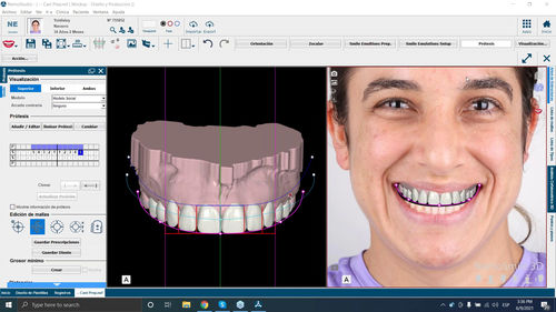 Software de diseño digital de la sonrisa - NemoSmile - Nemotec - de mejora de la imagen / de análisis de imágenes / de gestión de datos de pacientes