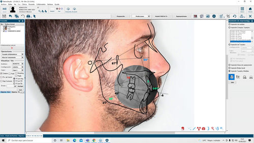 software de hospital - Nemotec