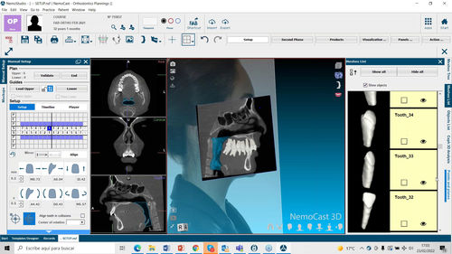 Software de planificación preoperatoria - NemoFab Ortho - Nemotec - médico / clínico / para odontología