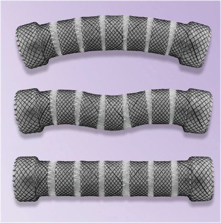 Stent esofágico - ESO-4-20-60-SEG - Creo Medical - de silicona / de nitinol / autoexpandible