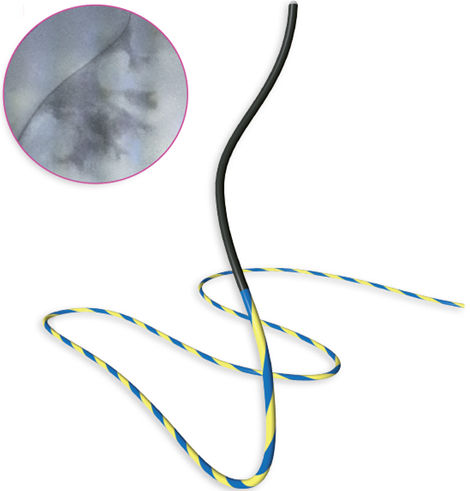 Hilo guía de sonda - Rio Tracer™ - ROCAMED - ureteral / hidrofílico