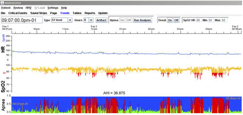 Software de prueba - LX Sleep - NorthEast Monitoring - de registro / de análisis / para polisomnografía