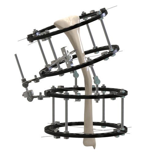 Fijador externo para tibia - 11611 series - Canwell Medical - híbrido / para adulto