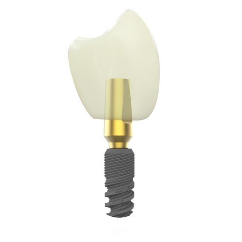 Implante dental cónico - Canwell Medical - de titanio / recto
