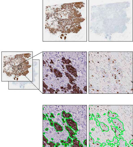 Módulo de software de análisis de imágenes - VirtualDoubleStaining™  - Visiopharm - de diagnóstico / de interpretación / clínico