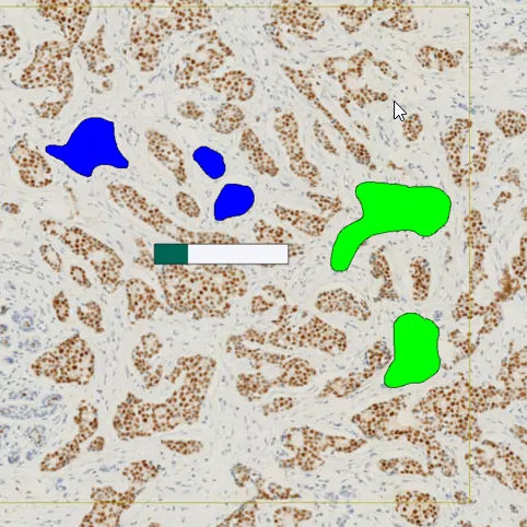 Módulo de software de oncología - ONCOTOPIX®  - Visiopharm - para inmunohistoquímica / para hibridación in situ con fluorescencia / de visualización
