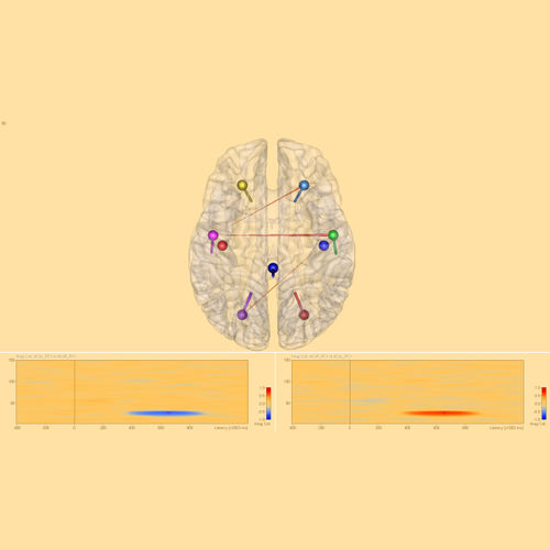 Software para EEG - Connectivity 2.0 - BESA GmbH - de análisis / de visualización