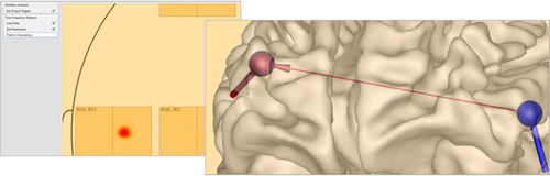 Software análisis de datos - Research 7.0 - BESA GmbH - médico / para EEG
