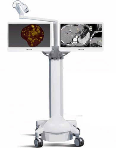 Sistema de navegación quirúrgica para la radiología intervencionista - CAS-One® IR - CAScination - óptico