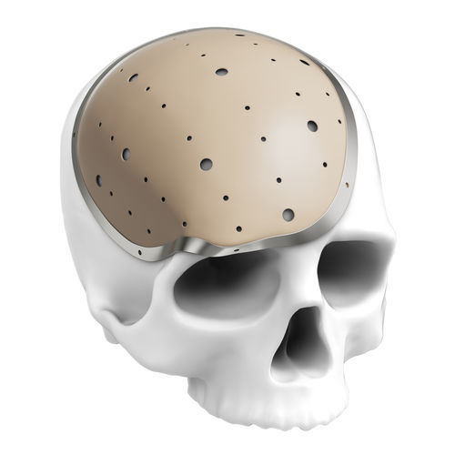 Implante craneal a medida - Kontour Medical Technology