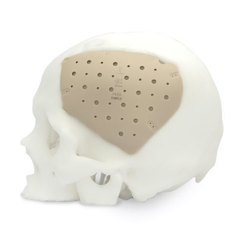 Implante craneal a medida - CranioPEEK3D ™ - Kontour Medical Technology