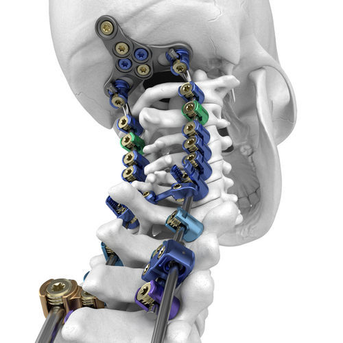 Sistema de osteosíntesis occipitocervicotorácico - NorthStar® - SeaSpine - vía posterior / para adulto