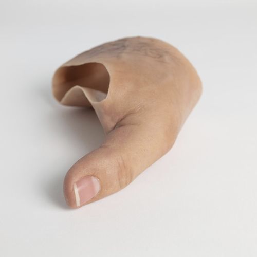Prótesis estética esterna de mano - schubert and braun prothesenwerk - parcial / para adulto