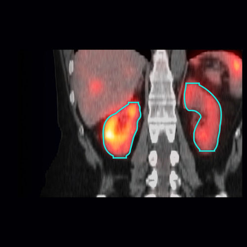 Software médico - MIM SurePlan™ MRT - Tema Sinergie - SPECT / de análisis / de visualización