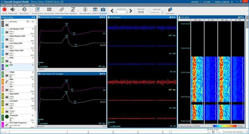 Software de gestión de datos - Cascade® - Cadwell Industries - para informes / de monitorización / de medición