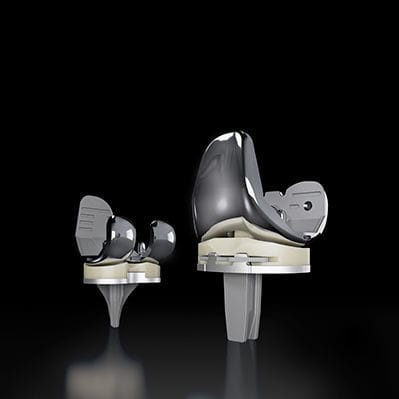 Prótesis de rodilla tricompartimental - TriVerse™ - Exactech - de platillo fijo / cementada